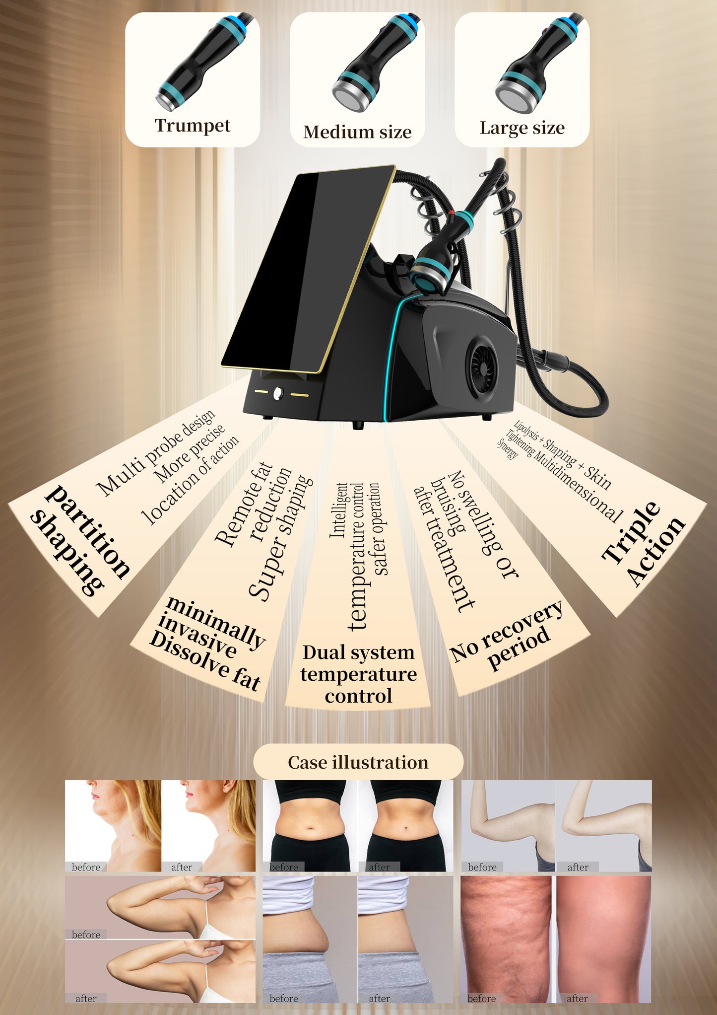 Onda Pro Coolwaves RF-Radiofrequency 2.45 GHz Slimming Body Sculpt & Face Body Tightening Cellulite Reduction Desktop Machine