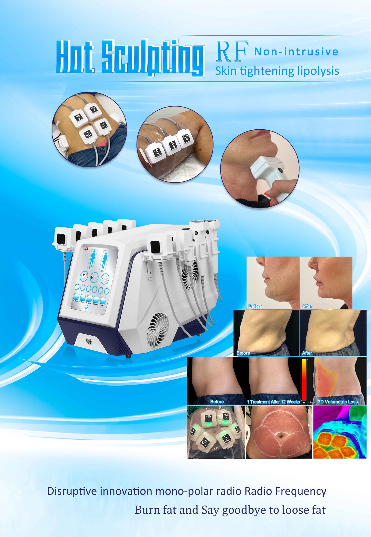 Cutera Id Radio Frequencia Body Sculpting Face Liftting Skin Tightening 10 Handles Monopolar Heat Cellulite Reduction Machine