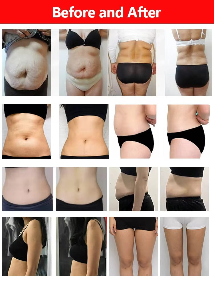 6D Lipolaser Technology Combined with EMS for Non-Invasive Body Contouring and Cellulite Reduction Slimming Machine