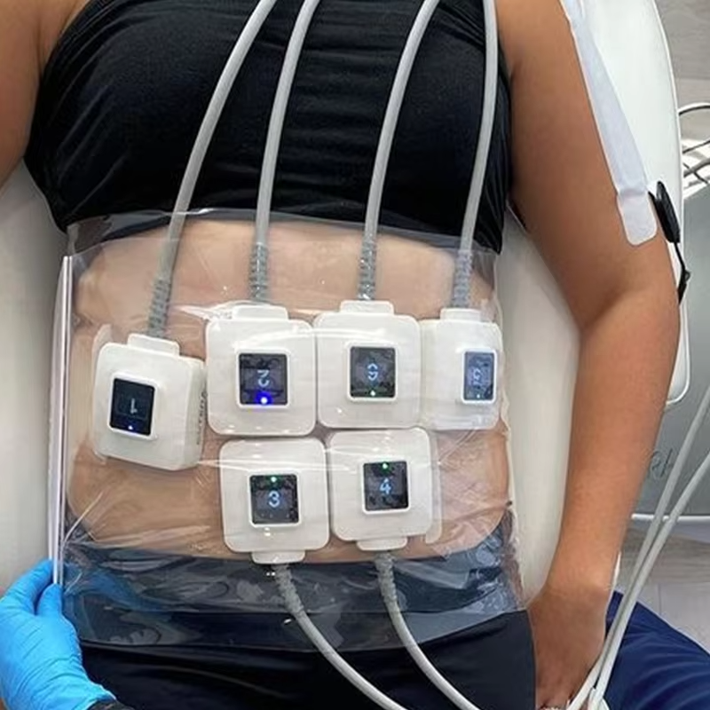 Cutera Id Radio Frequencia Body Sculpting Face Liftting Skin Tightening 10 Handles Monopolar Heat Cellulite Reduction Machine