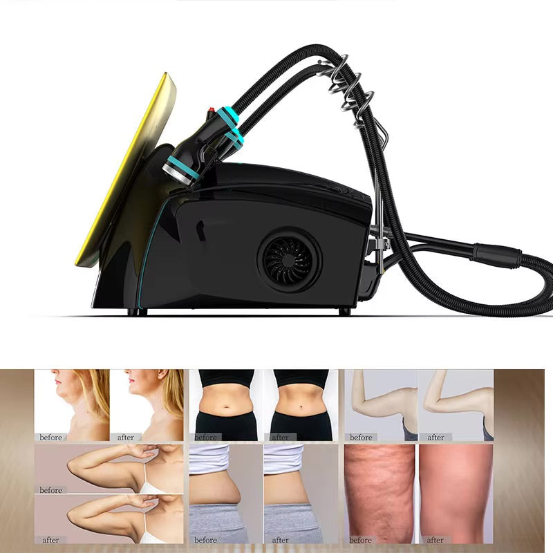 Onda Pro Coolwaves RF-Radiofrequency 2.45 GHz Slimming Body Sculpt & Face Body Tightening Cellulite Reduction Desktop Machine