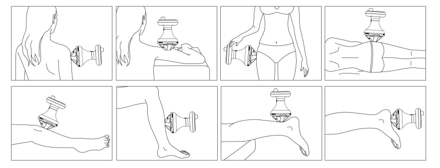2025 FSWT Foco Focal Fisioterapia con Ondas de Choque Extracorpóreas Alivio del Dolor Terapia con Ondas de Choque Focalizadas de Baja Intensidad Liswt para el Pene