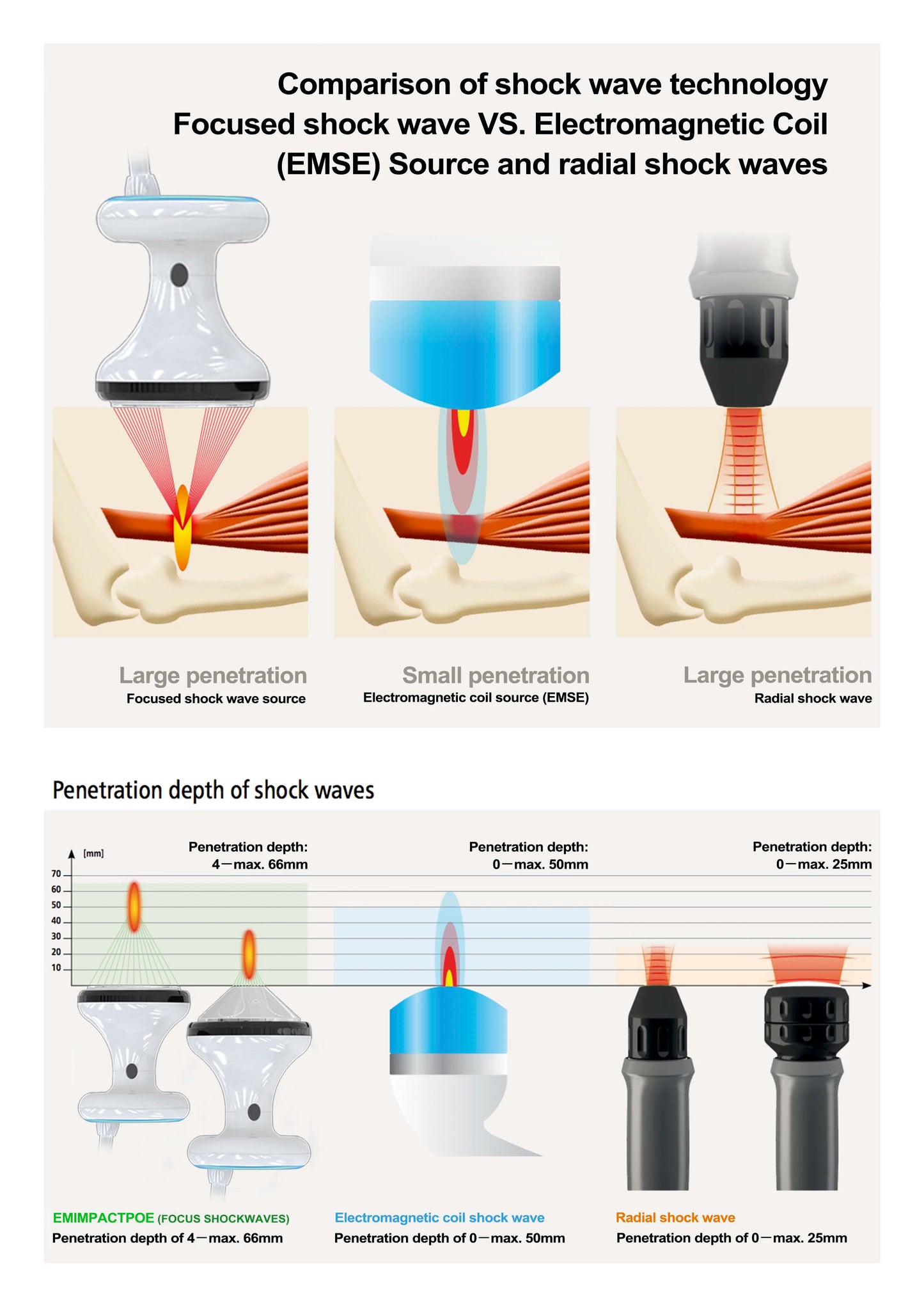 2025 FSWT Foco Focal Fisioterapia con Ondas de Choque Extracorpóreas Alivio del Dolor Terapia con Ondas de Choque Focalizadas de Baja Intensidad Liswt para el Pene