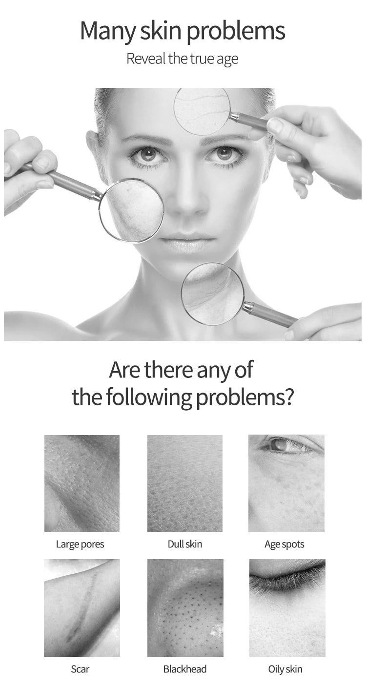 6 in 1 Microdermabrasion Aqua Peel Deep Cleaning Skin Tightening Portable Hydro Water Facial Jet Machine Hydrofacials Machine